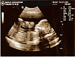 House invasion today-ultrasound.jpg